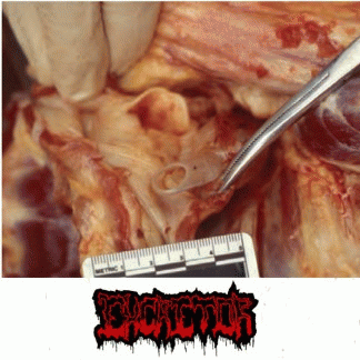 Excretor : Demo 2016